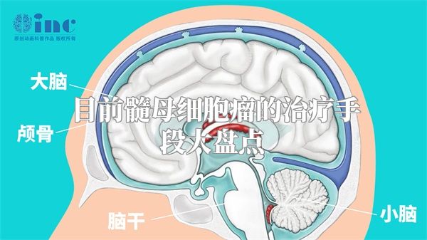 目前髓母细胞瘤的治疗手段大盘点