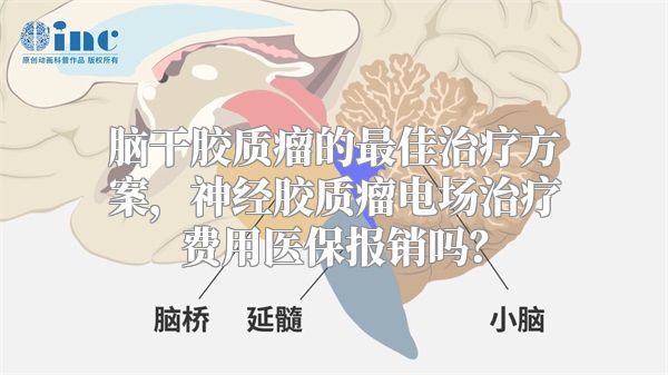 脑干胶质瘤的最佳治疗方案，神经胶质瘤电场治疗费用医保报销吗？