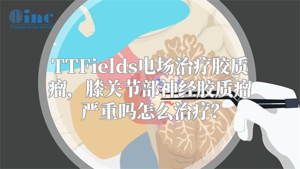 TTFields电场治疗胶质瘤，膝关节部神经胶质瘤严重吗怎么治疗？