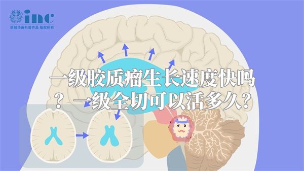 一级胶质瘤生长速度快吗？一级全切可以活多久？