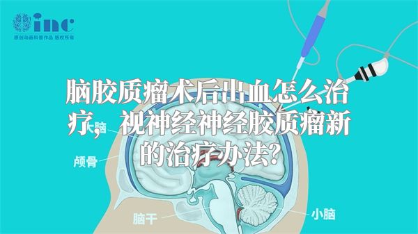 脑胶质瘤术后出血怎么治疗，视神经神经胶质瘤新的治疗办法？