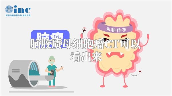 脑胶质母细胞瘤CT可以看出来