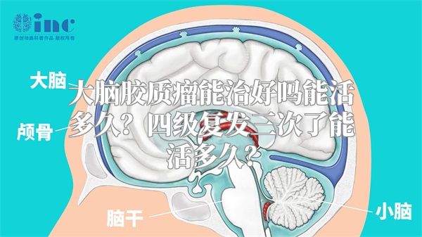 大脑胶质瘤能治好吗能活多久？四级复发三次了能活多久？