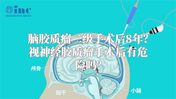 脑胶质瘤二级手术后8年？视神经胶质瘤手术后有危险吗？