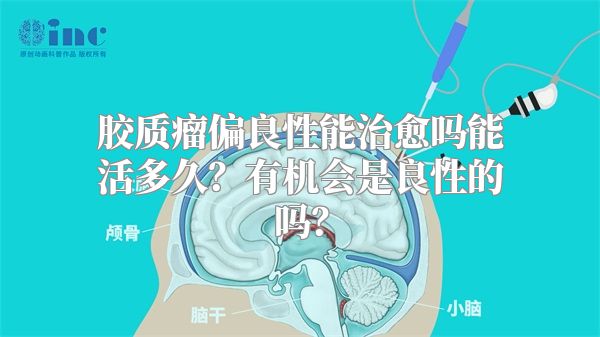 胶质瘤偏良性能治愈吗能活多久？有机会是良性的吗？