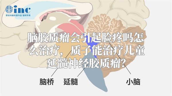 脑胶质瘤会引起脸疼吗怎么治疗，质子能治疗儿童延髓神经胶质瘤？