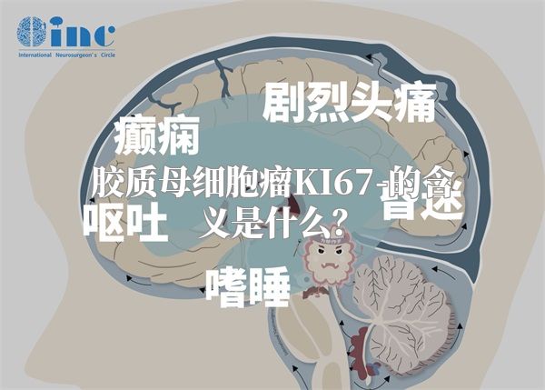 胶质母细胞瘤KI67-的含义是什么？