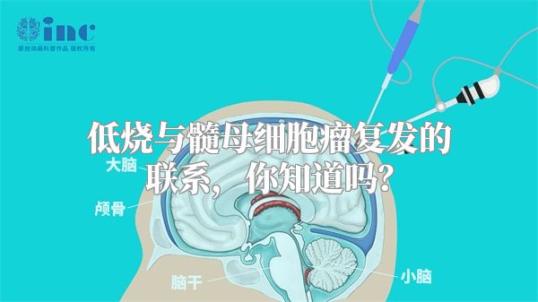 低烧与髓母细胞瘤复发的联系，你知道吗？