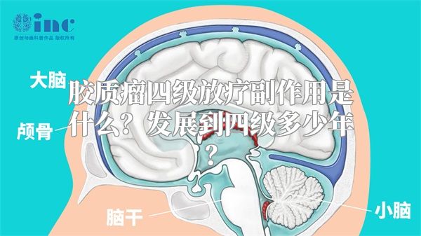 胶质瘤四级放疗副作用是什么？发展到四级多少年？