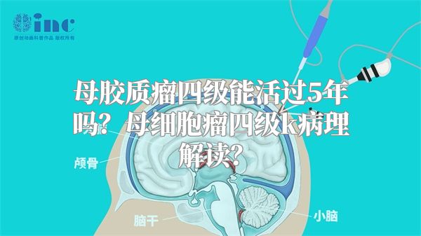 母胶质瘤四级能活过5年吗？母细胞瘤四级k病理解读？