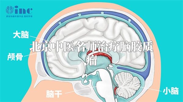 北京中医名师治疗脑胶质瘤