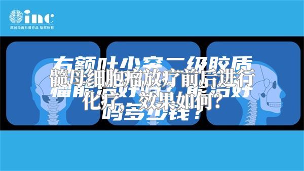 髓母细胞瘤放疗前后进行化疗，效果如何？