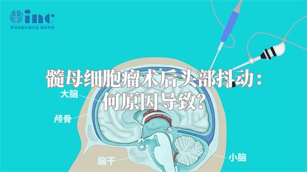 髓母细胞瘤术后头部抖动：何原因导致？