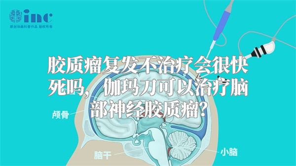 胶质瘤复发不治疗会很快死吗，伽玛刀可以治疗脑部神经胶质瘤？