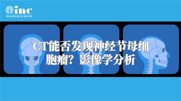 CT能否发现神经节母细胞瘤？影像学分析