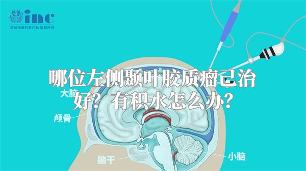 哪位左侧颞叶胶质瘤己治好？有积水怎么办？