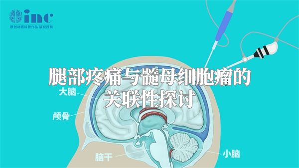 腿部疼痛与髓母细胞瘤的关联性探讨