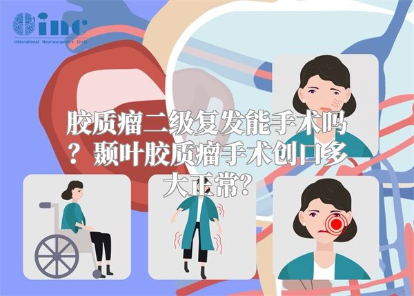 胶质瘤二级复发能手术吗？颞叶胶质瘤手术创口多大正常？