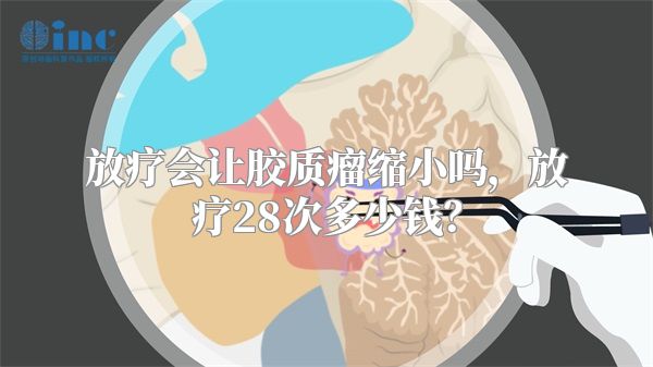 放疗会让胶质瘤缩小吗，放疗28次多少钱？