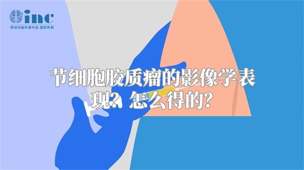 节细胞胶质瘤的影像学表现？怎么得的？