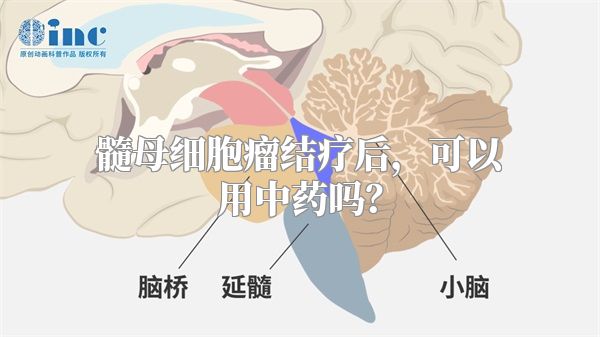 髓母细胞瘤结疗后，可以用中药吗？