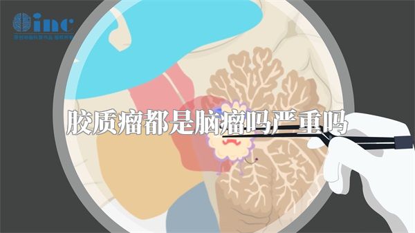 胶质瘤都是脑瘤吗严重吗