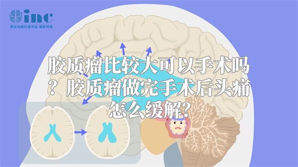 胶质瘤比较大可以手术吗？胶质瘤做完手术后头痛怎么缓解？