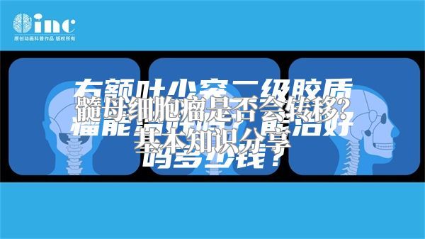 髓母细胞瘤是否会转移？基本知识分享