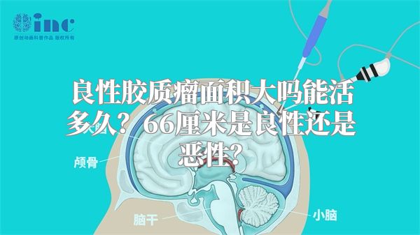 良性胶质瘤面积大吗能活多久？66厘米是良性还是恶性？