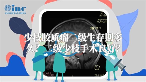 少枝胶质瘤二级生存期多久？二级少枝手术良好？