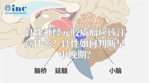 良性神经元胶质瘤应该注意什么？良性如何判断早中晚期？