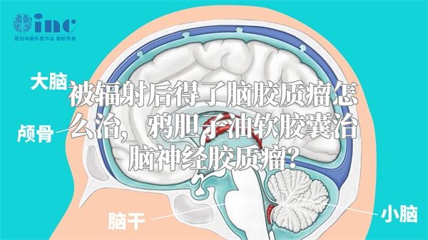 被辐射后得了脑胶质瘤怎么治，鸦胆子油软胶囊治脑神经胶质瘤？