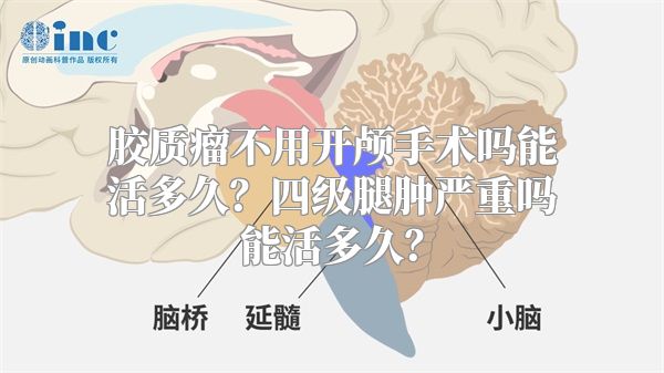 胶质瘤不用开颅手术吗能活多久？四级腿肿严重吗能活多久？