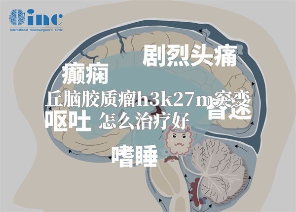 丘脑胶质瘤h3k27m突变怎么治疗好  