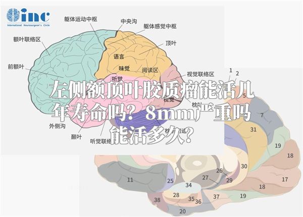 左侧额顶叶胶质瘤能活几年寿命吗？8mm严重吗能活多久？