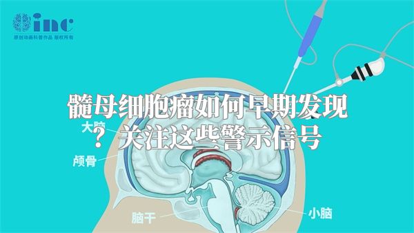 髓母细胞瘤如何早期发现？关注这些警示信号