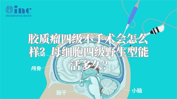 胶质瘤四级不手术会怎么样？母细胞四级野生型能活多久？