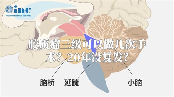 胶质瘤三级可以做几次手术？20年没复发？