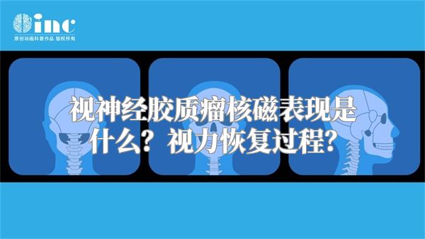 视神经胶质瘤核磁表现是什么？视力恢复过程？