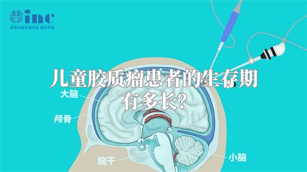 儿童胶质瘤患者的生存期有多长？