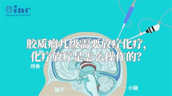 胶质瘤几级需要放疗化疗，化疗放疗是怎么操作的？