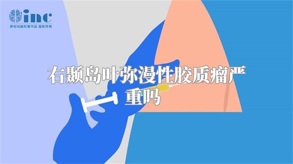 右颞岛叶弥漫性胶质瘤严重吗  