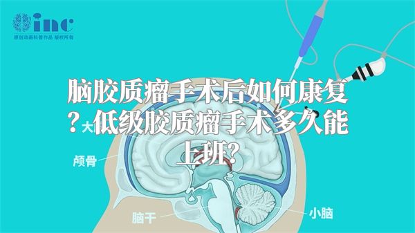 脑胶质瘤手术后如何康复？低级胶质瘤手术多久能上班？