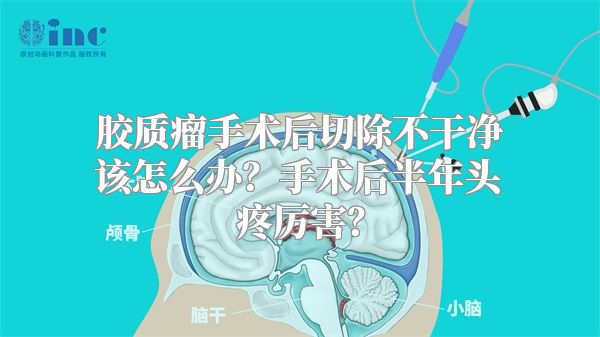 胶质瘤手术后切除不干净该怎么办？手术后半年头疼厉害？