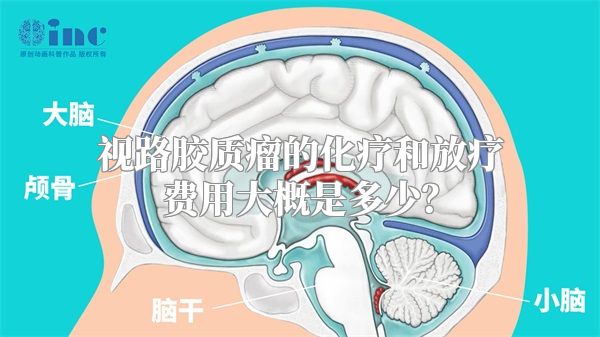 视路胶质瘤的化疗和放疗费用大概是多少？