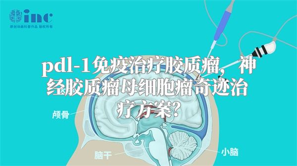 pdl-1免疫治疗胶质瘤，神经胶质瘤母细胞瘤奇迹治疗方案？