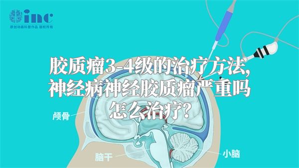 胶质瘤3-4级的治疗方法，神经病神经胶质瘤严重吗怎么治疗？