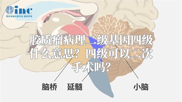 胶质瘤病理二级基因四级什么意思？四级可以二次手术吗？