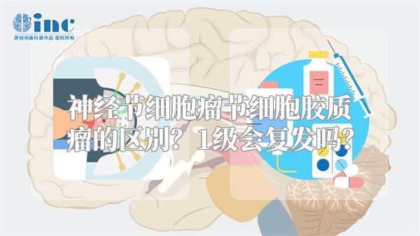 神经节细胞瘤节细胞胶质瘤的区别？1级会复发吗？