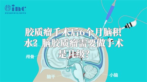 胶质瘤手术后6个月脑积水？脑胶质瘤需要做手术是几级？